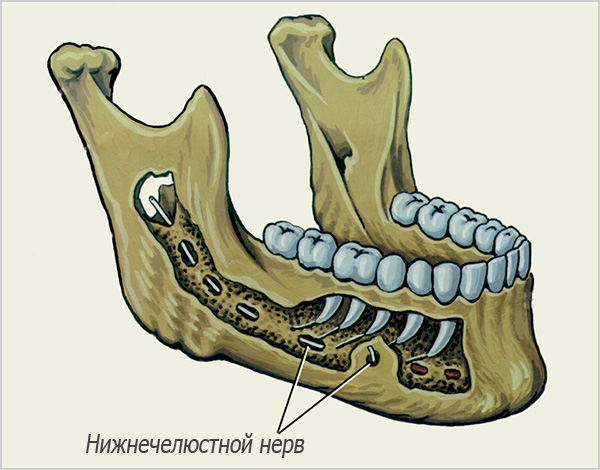 La photo montre le passage du nerf mandibulaire dans la mâchoire inférieure.