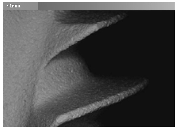 La photo montre la surface de l'implant Alpha Bio au microscope.