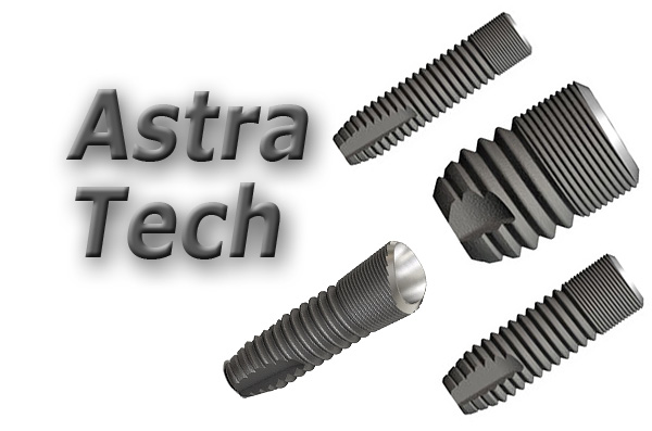 Nous considérons les avantages et les inconvénients des implants Astra Tech (Suède) ...