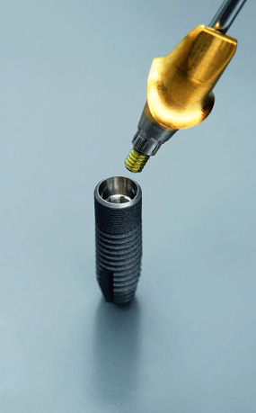 Les implants Astra Tech ont une connexion conique très précise avec le pilier.